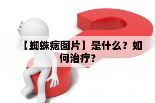 【蜘蛛痣图片】是什么？如何治疗？