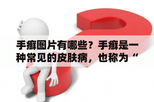 手癣图片有哪些？手癣是一种常见的皮肤病，也称为“癣症”或“皮癣病”。它常常会出现在手指和手掌的表面，引起瘙痒、疼痛、裂纹和炎症等不适症状。为了更好的了解手癣病情，许多患者会寻找手癣的图片来进行比对、辨别和了解治疗情况。下面就为您介绍手癣图片。