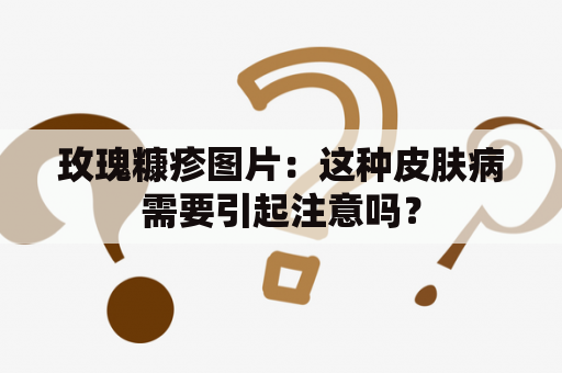 玫瑰糠疹图片：这种皮肤病需要引起注意吗？