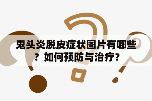 鬼头炎脱皮症状图片有哪些？如何预防与治疗？