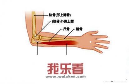 什么是网球肘？有哪些方法能帮助康复治疗