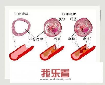 亚麻籽减肥正确吃法