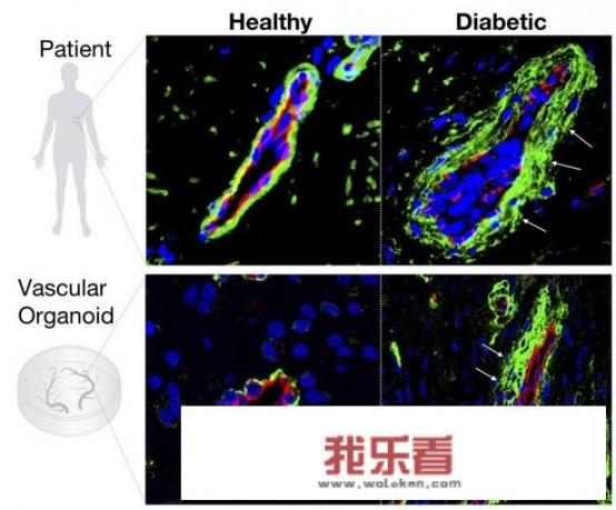 为什么玩一会游戏眼睛就流眼泪？