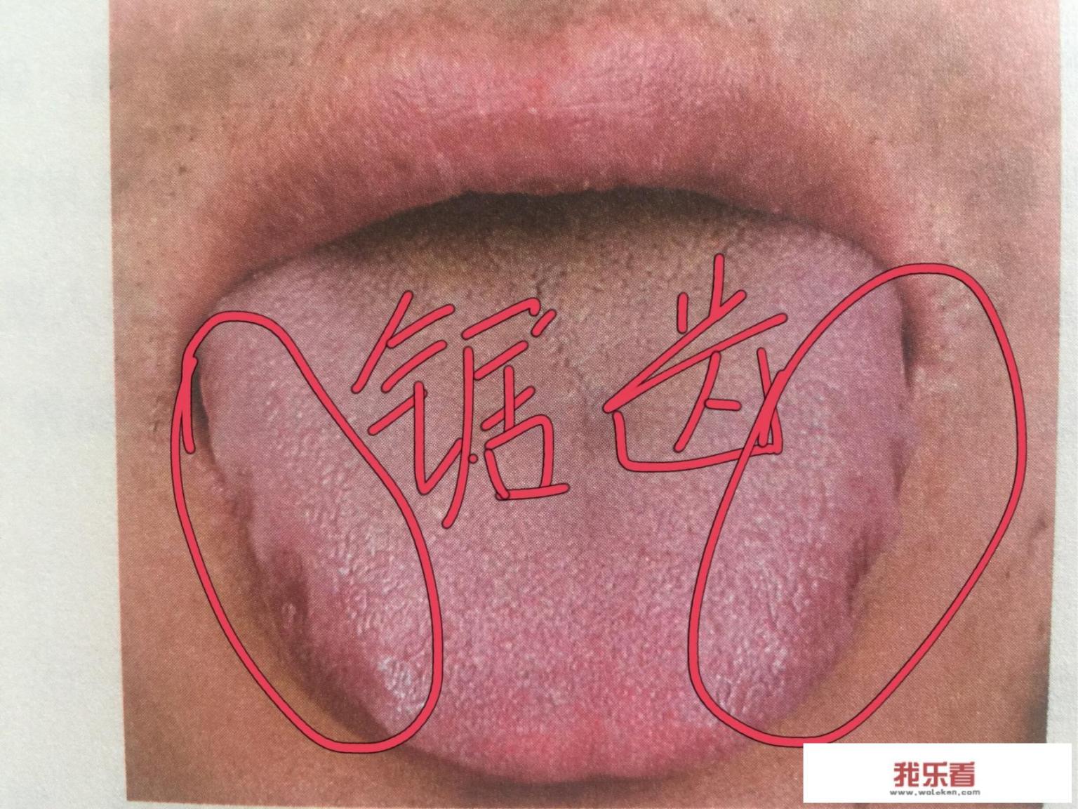 吃什么食物补血快？