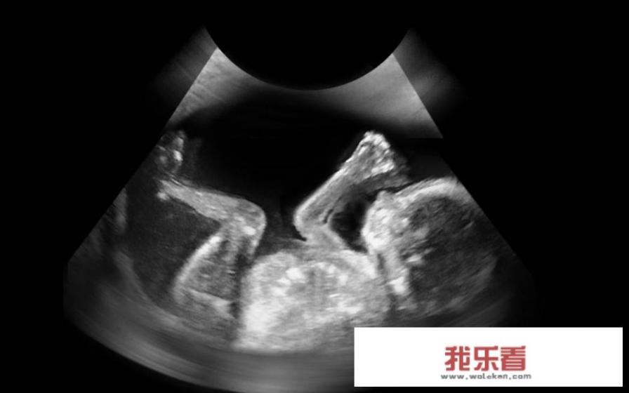 自己种的葡萄熟了怎么发朋友圈？