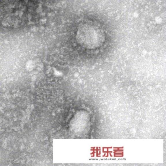 新型冠状病毒是啥颜色的？为什么有图片是红色的，有的是绿色的？