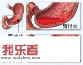 胃部一阵一阵的疼痛，怎么回事？