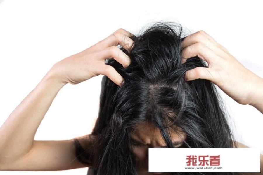 溢脂性脱发用洗发水用带硅油的还是无硅油的好？
