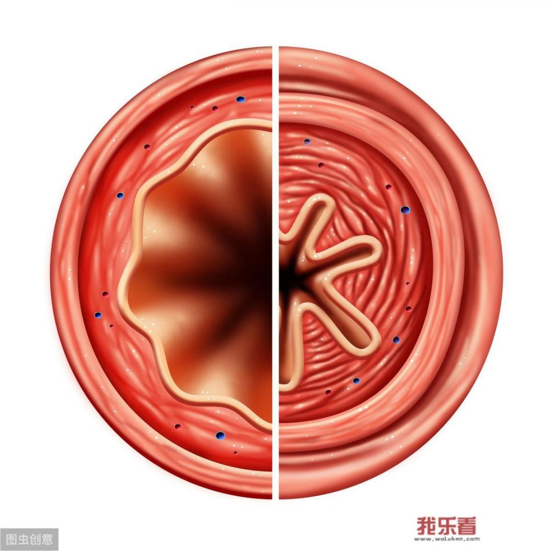 没有痰，干咳吃什么药管用？