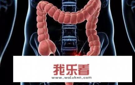 排便时出现的“4种异常”，千万别忽略，很可能是肠癌找上门，你知道哪4点吗？