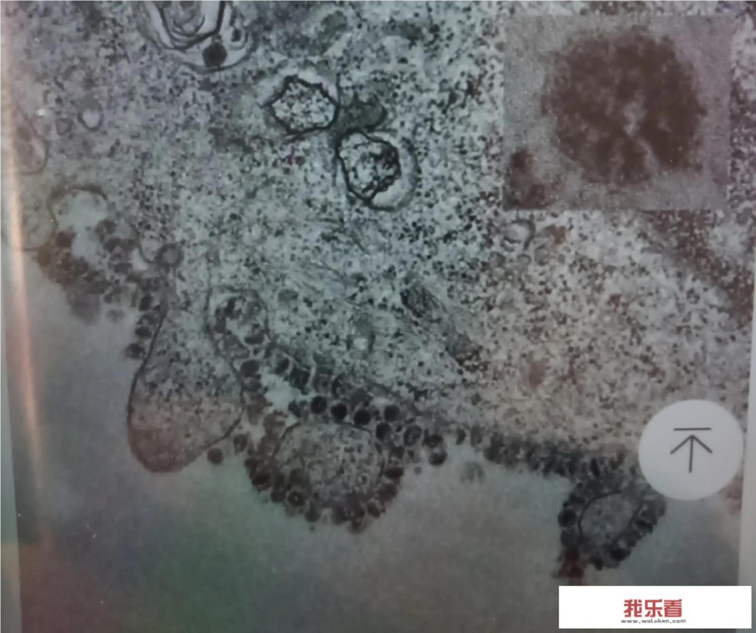 新型冠状病毒是啥颜色的？为什么有图片是红色的，有的是绿色的？